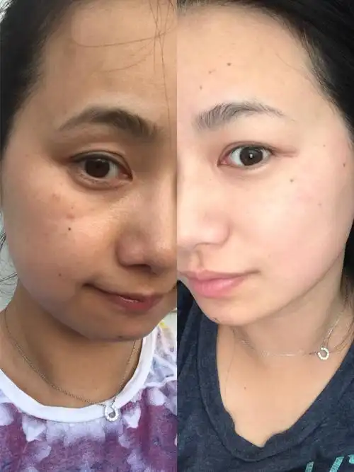 的美白历程,自报家门,奔四的老阿姨,皮肤中性偏干 是不是很吓人的对比