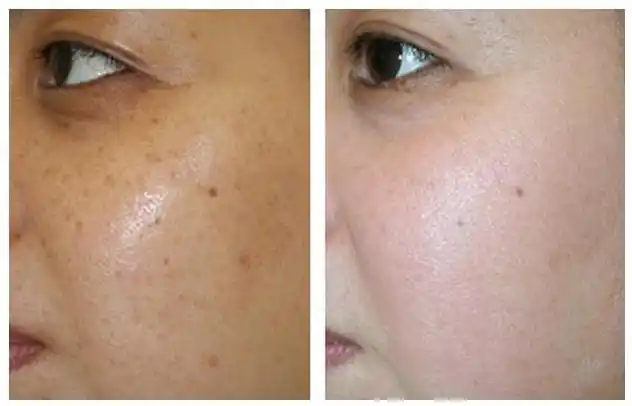 皮肤暗黄暗沉身体该如何调理