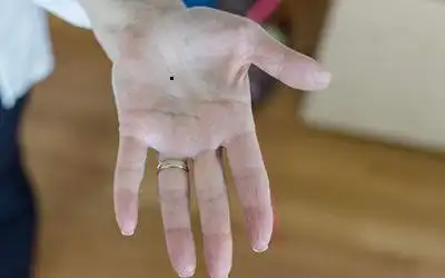 女人左手掌心痣代表什么掌心痣好吗