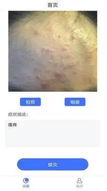 扫一扫识别皮肤病