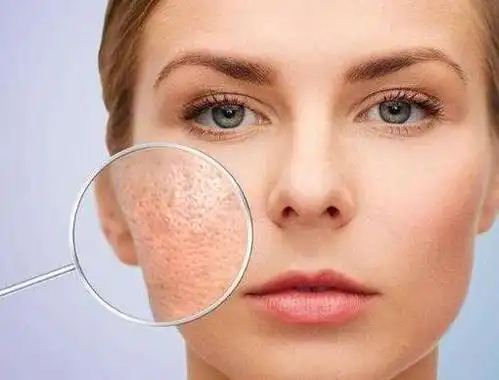 毛孔粗大怎么解你要的方法都在这里啦