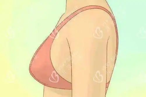 胸松松垮垮软软下垂怎么办解决松软下垂胸三个靠谱方法公布