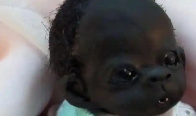 被称为世界上最黑的孩子出生在南非,很多人都知道非洲的皮肤都是黑色