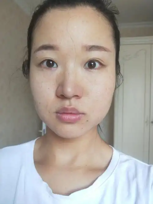 35岁早上起来睡好了皮肤状态不错