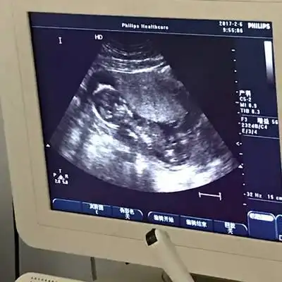 四个月,帮忙看看是男宝女宝呀?太好奇啦!本人没有性别之分哦!