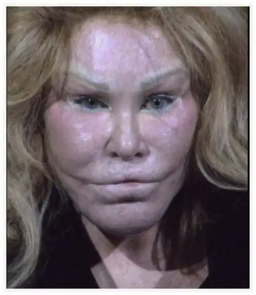 她因离婚获得20亿美元赔偿,迷恋上整容后,整个人都变了!