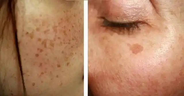 壹知肤:皮肤暗沉多斑的看过来!学会这几招,你也能"逆生长"!