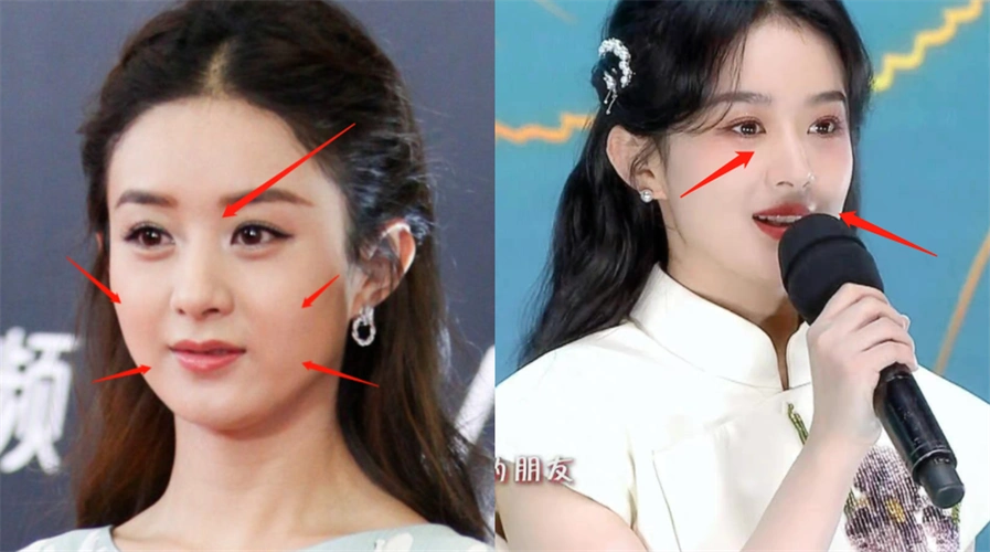 赵丽颖有整过容吗(造型影响服化道的翻车却被质疑是整容) - 品度娱乐