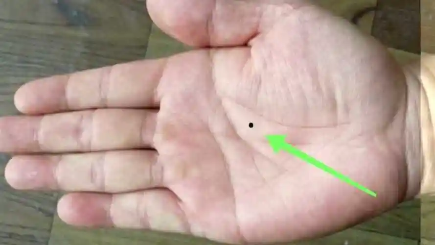 手心痣聚财的象征手相痣解析