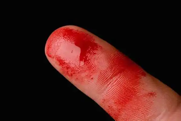 手指流血图片52
