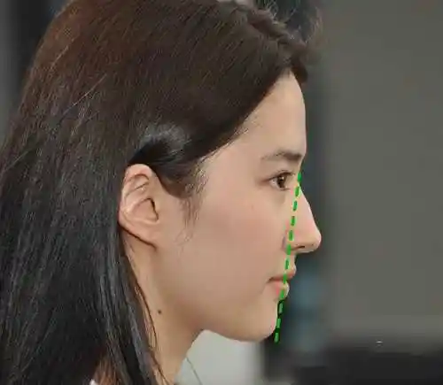 过于西化的直面型线条也不适合东方人的柔和五官,最适合东方人的侧脸