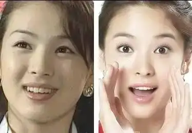 哪个明星整牙前后的对比最吓人?