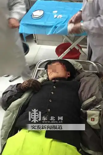 环卫工陶某额头出血.迟亦达 摄