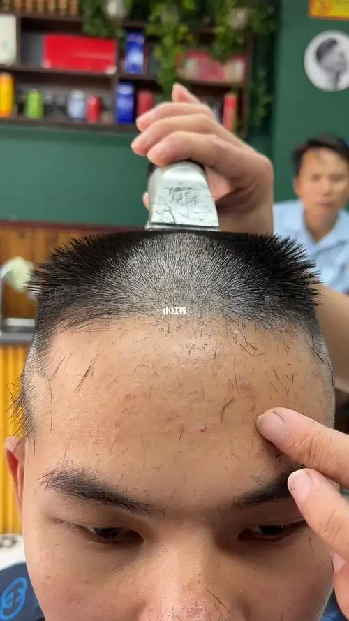 了～这是三面光还是传说中的地中海平头……傻傻分不清楚了#男士发型