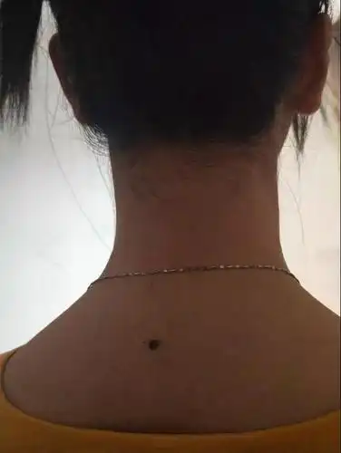 痣相算命背部有痣好不好