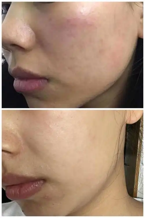 干性皮肤得救了,干皮也有滋润的一天