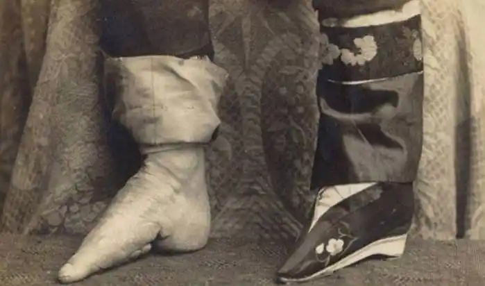 她16岁因"三寸金莲"嫁给大户,从来不露脚,90年来只有丈夫见过