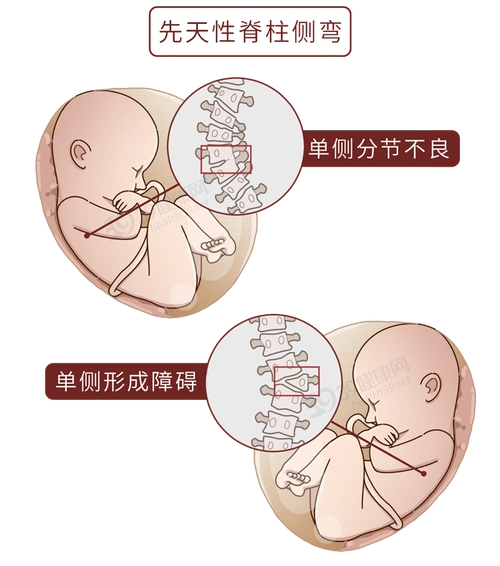 正确坐姿图片(正确坐姿的要点介绍)