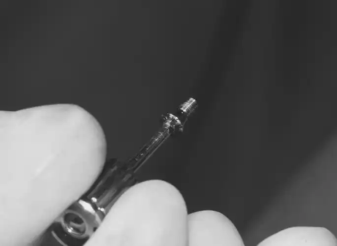 正大华盛口腔一例即刻拔牙即刻种植病例