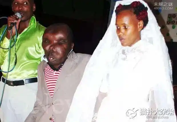 世界上最恶心的人,又丑又恶心的男人和女人(图片)