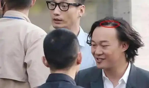 "看似帅气难挡,实则脱发严重"的9位男星,个个心酸又好笑