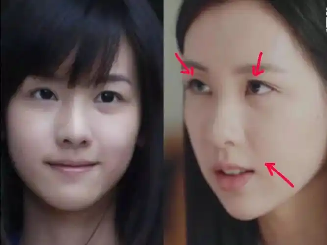 为什么8分的陈都灵比5分的沈月还显老?_颧骨