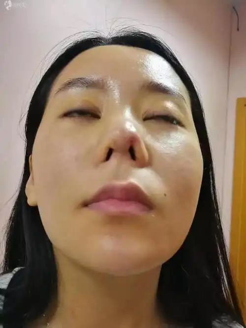 鼻子失败.jpg