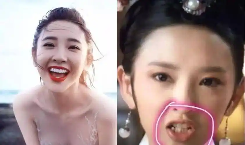 原创亮瞎眼明星烤瓷牙变灾难嘴包不住牙嘴凸变老演戏难看