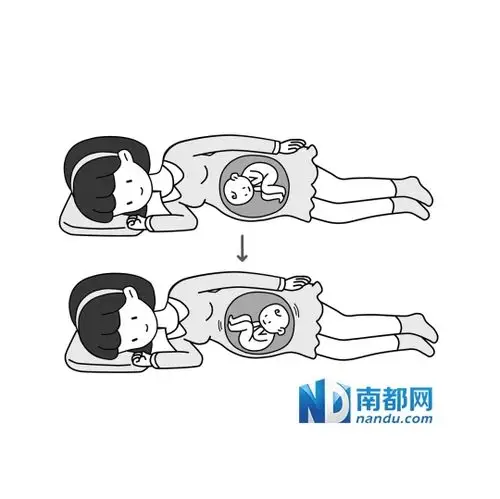 "臀位"宝宝如何转正?
