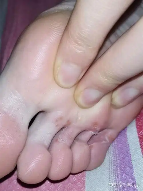 我觉得我的脚丫子有点酸臭酸臭的要怎么把脚变香啊