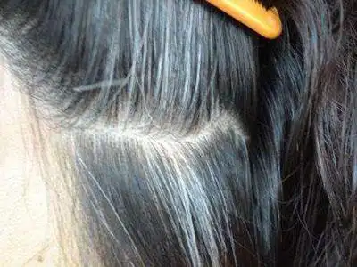 年轻人为何长白头发 年轻人为何长白头发多