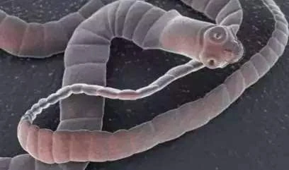 女子乳房里取出20厘米的寄生虫,吃这些东西一定要小心!