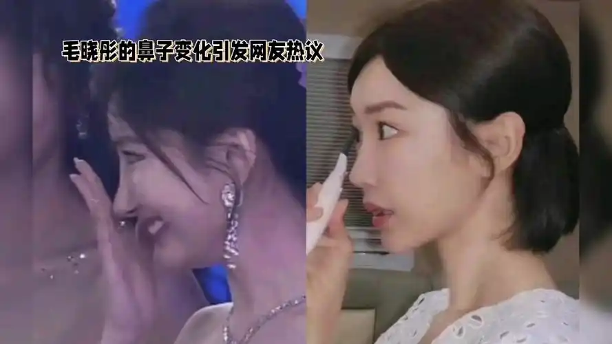 毛晓彤的鼻子变化引发网友热议