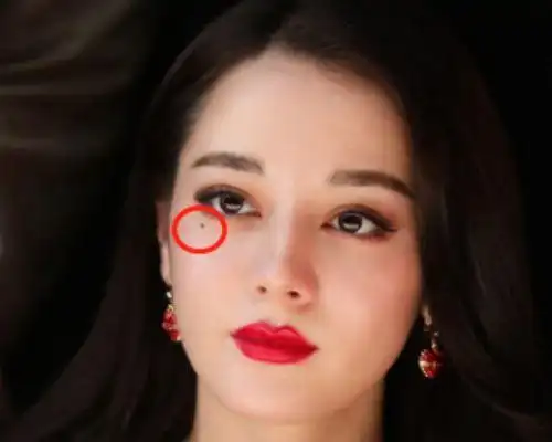 女生脸上的"美人痣",主要在哪些地方?颧骨眼尾很常见