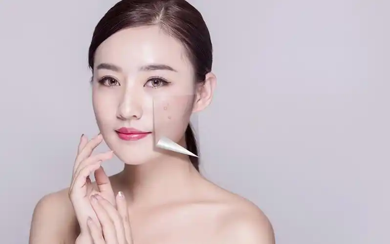 真的能变白吗?_皮肤