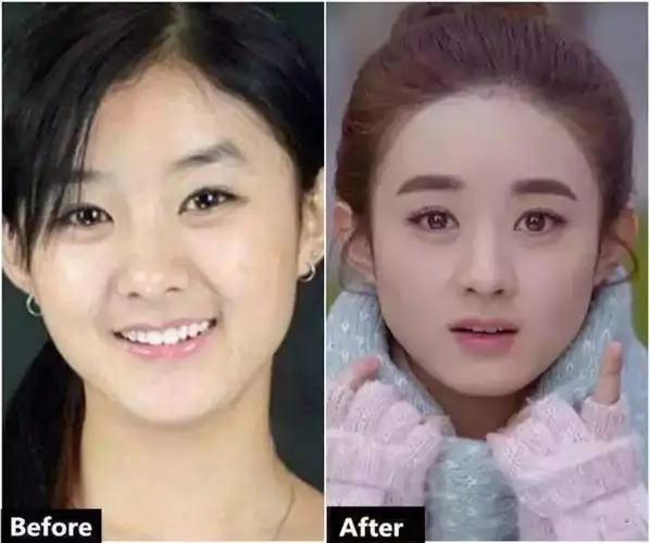 可以看到,赵丽颖的鼻子比之前精致了不少!