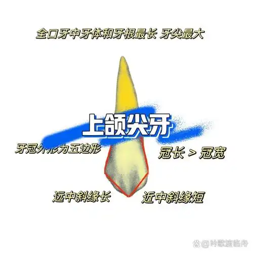 舌面,近中面,远中面,牙尖组成 上颌尖牙体积宽大,牙冠唇舌径明显大于
