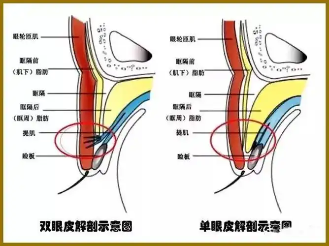 眼睑的组织结构与重睑术 - 好大夫在线