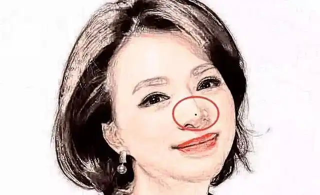 脸上五个小人痣,不点就等着破财败运!