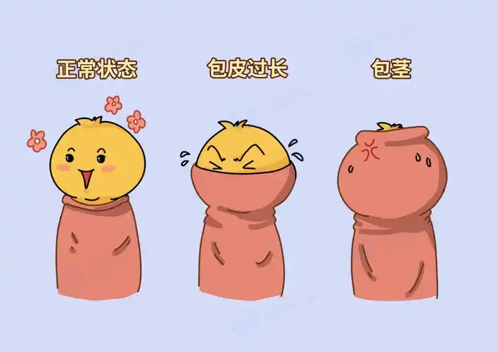 是因为我属于包茎,不是普通的包皮过长,割完后洗澡再也不用努力翻包皮