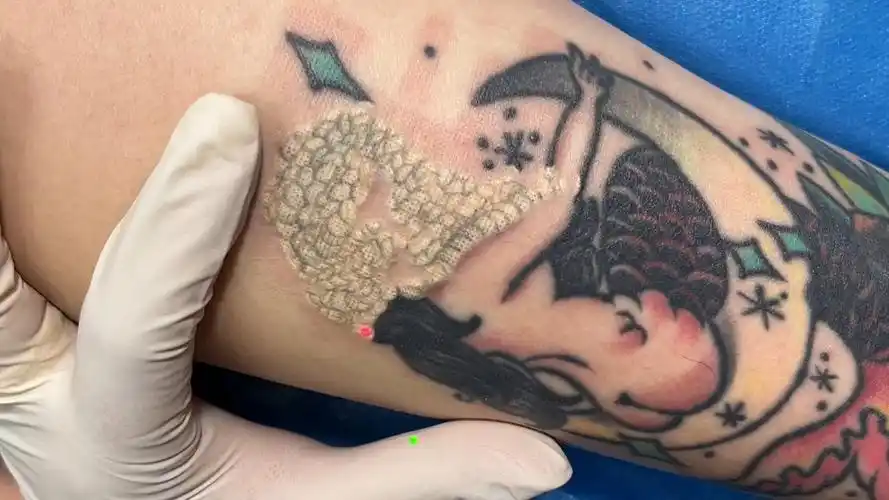 美女脚踝彩色纹身清洗记录,全程无痛,沉浸式解压洗纹身