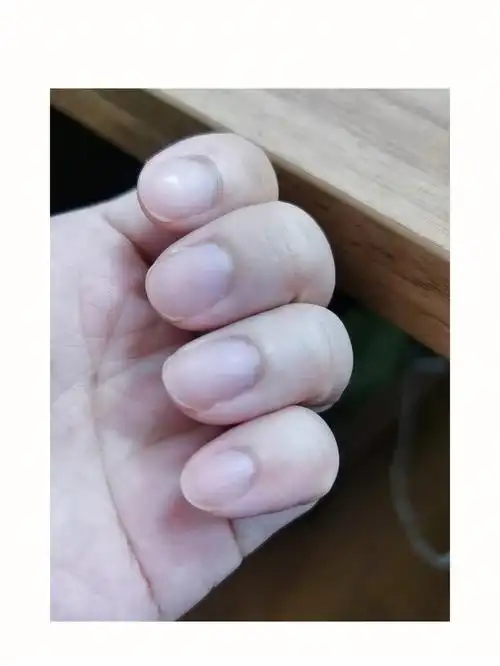 指甲甲床太长了,按432弦都会碰到后面一根,所以最近一有空就使劲磨