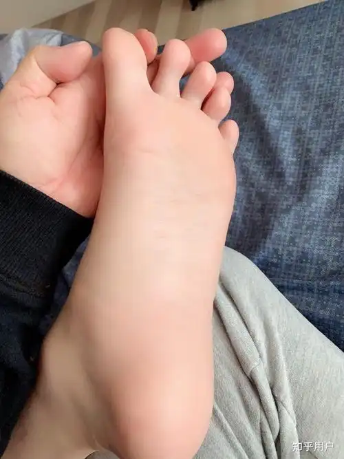 我听我朋友说,女生的脚底板更红润,真的吗? - 知乎