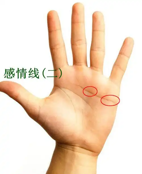 十分准确的手相测病详解