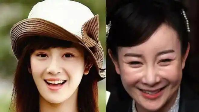 满脸玻尿酸笑比哭难看这10位填充过度的明星个个一言难尽