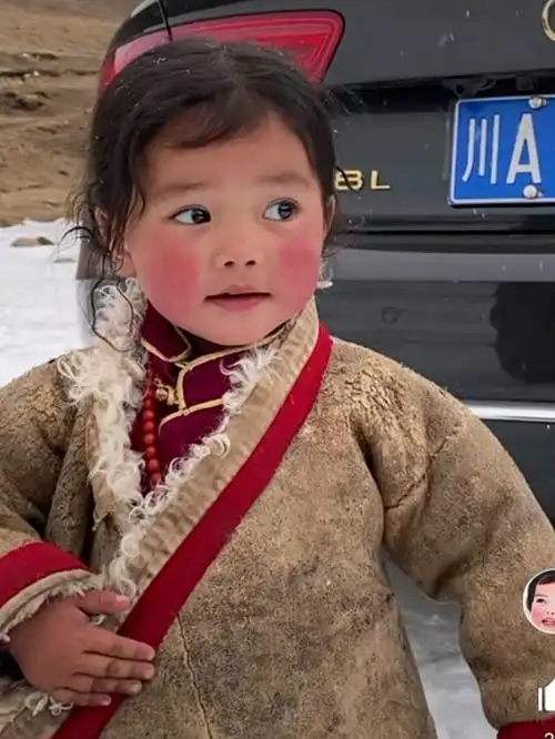 清澈的双眸,纯真的笑脸,雪花绽放在高原红的脸蛋上,_圈子-新氧美容整