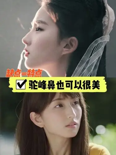 缺点=特点 驼峰鼻也可以非常美