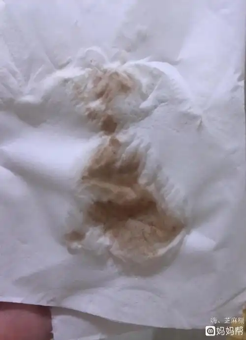 孕早期褐色血一直流怎么办