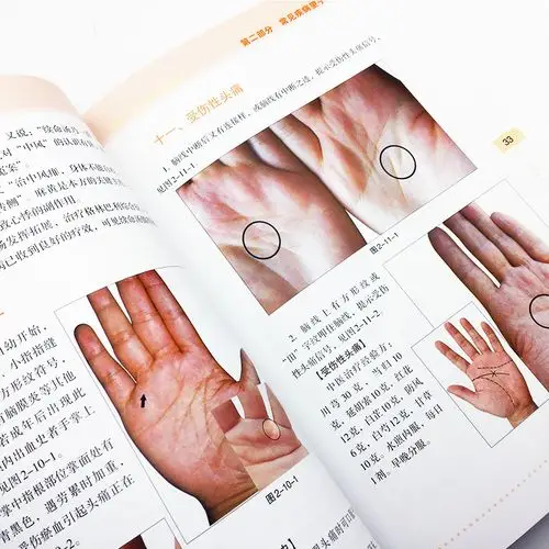 正版【赠光盘】手诊快速入门 第2版 手诊书籍图解大全 中医诊断手诊