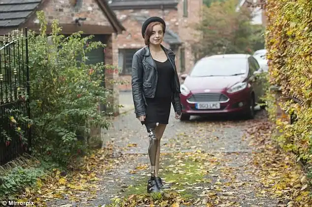 英独腿女孩被告知因残疾程度不够无资格用救济车